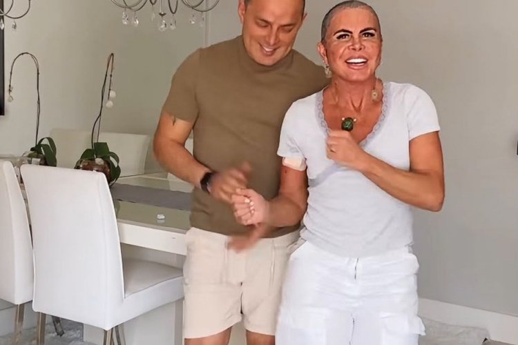 Gretchen e Esdras: casal se diverte após transplante capilar​‌​